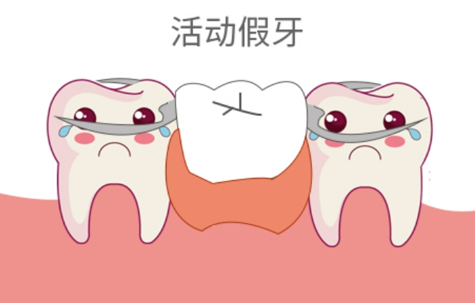 佩戴活动义齿时,如果发现得了口腔溃疡怎么办？