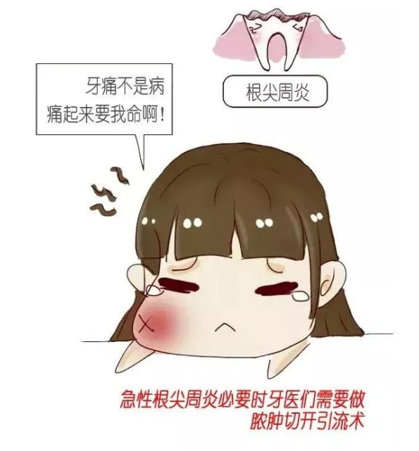 根尖周炎有哪些症状？