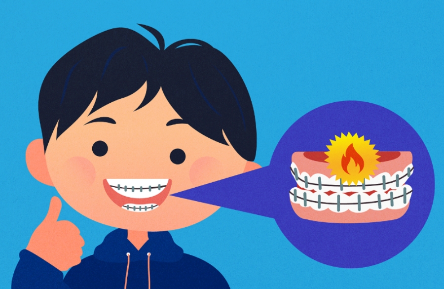 小孩牙齿咬合不齐，用什么方法矫正牙齿？