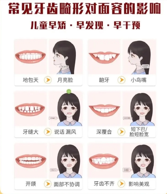 儿童牙齿早期干预有哪些具体服务内容？