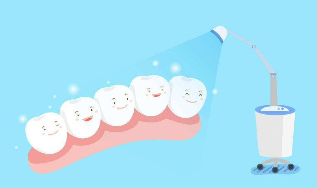 牙齿美白有哪几种方式？性价比高的是那种？