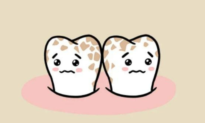 治疗四环素牙需要多久时间？