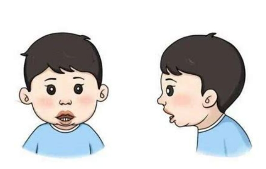如何预防儿童龋齿？