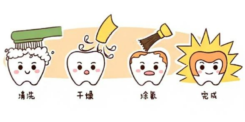 儿童涂氟需要多长时间才能完成？