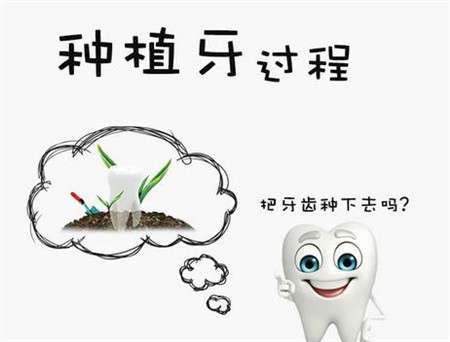 口腔医院种牙一般多少钱？
