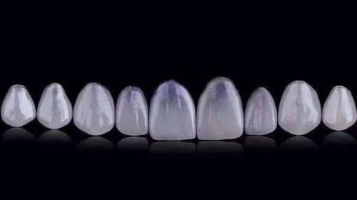 牙齿贴片是保护牙齿吗？牙齿贴片有哪些优点？