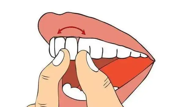 烤瓷牙能解决哪些问题？一般烤瓷牙能使用几年？