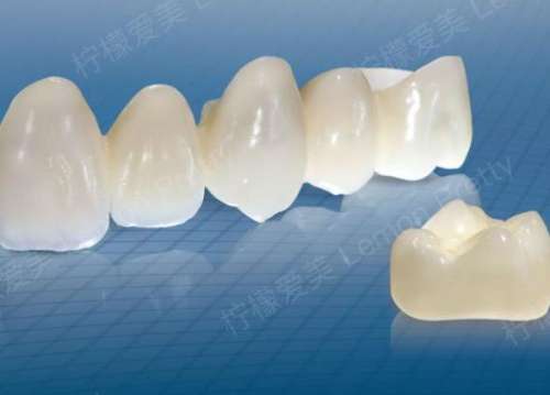 门牙牙缝大怎么修复好？烤瓷牙修复好吗？