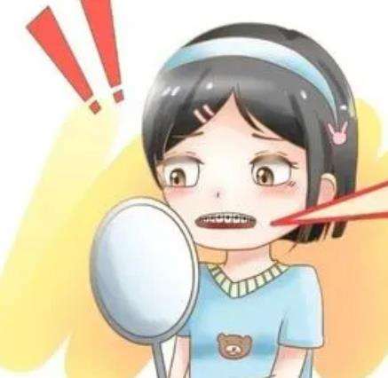 全瓷贴面托尔是什么？效果怎么样？