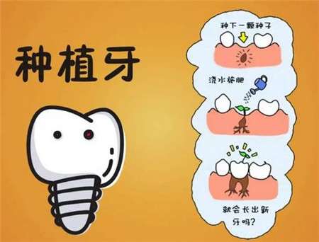 种植牙与传统缺牙修复方法有什么区别？