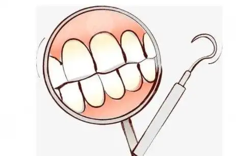 正颌手术前一定要正畸吗？术前正畸和普通正畸一样吗