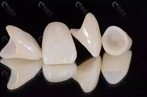 常见义齿的详细解析与使用指南