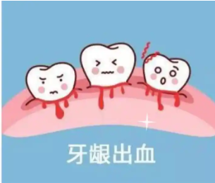 牙龈为什么会流血 ？应该怎么预防？
