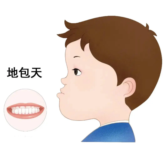 地包天的情况该如何处理？有效解决方案有哪些？