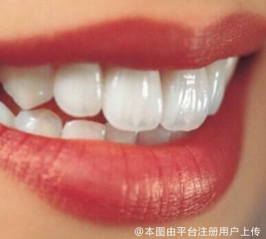 出现牙周炎，该怎么办？